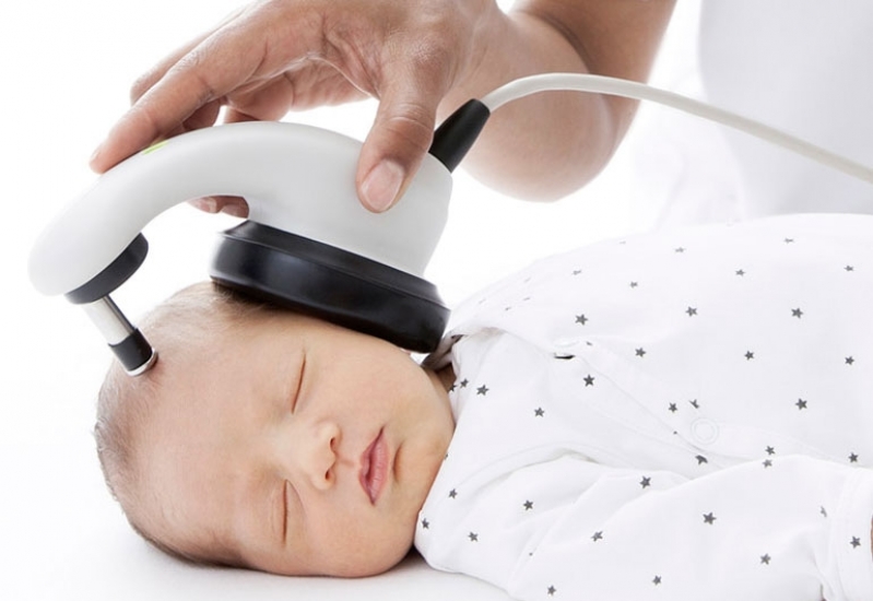 Valor de Exame de Ouvido Bera Aliança - Exame Bera em Bebê - Clínica Aura  Aparelhos e Próteses Auditivas